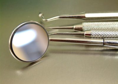Implantes Dentários