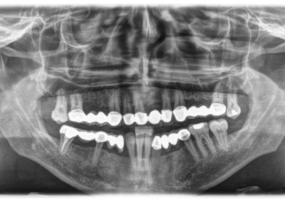 Ortopantomografia / Telerradiografia