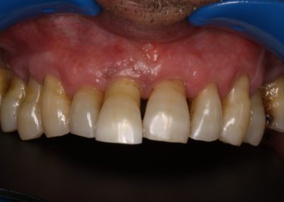 Periodontologia