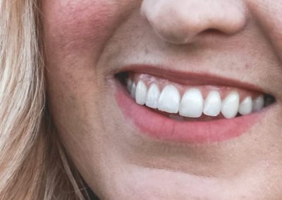 Medicina Dentária Estética